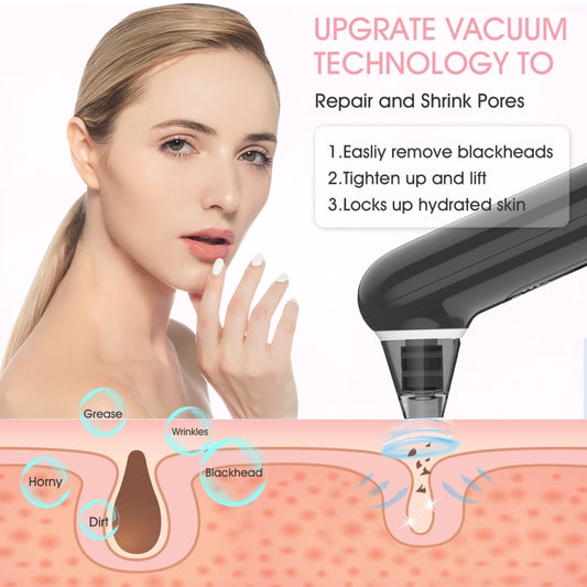 Electric Beauty Instrument Face Pore Remover Blackhead Acne Cleaner, XPRE202